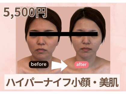 マイディア サロン(Mydear Salon)の写真
