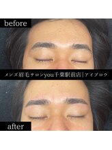 ユー 千葉駅前店(you)/ビフォ－アフター写真