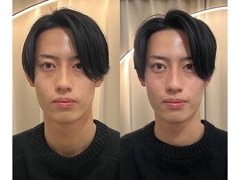 リンドウ 赤坂店(RINDO)の写真/国家資格保持者による施術で歪み、むくみを整え、理想のフェイスラインへ導く小顔ケア◎