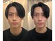 リンドウ 赤坂店(RINDO)の写真/国家資格保持者による施術で歪み、むくみを整え、理想のフェイスラインへ導く小顔ケア◎