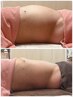 「認定店記念スペシャルメニュー」赤岩式腸削り+背面筋膜リリースで全身整体