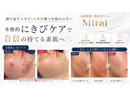 ミライ(Mirai)の写真