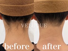 ヴェルーク(VELUQUE)の雰囲気（うなじ脱毛ビフォーアフター♪）
