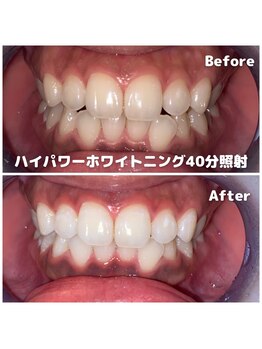 ライトビューティー 関内店(LIGHT BEAUTY)/[大事なご用事、お出かけ前に]
