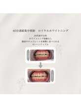 プラスビーセルフ(+b self)/ホワイトニングビフォーアフター