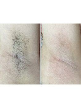 1回ごとにお支払い可能なサロン