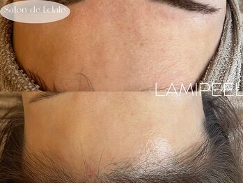 サロンドエクラル(Salon de Eclale wax)/◇LaminationPeel◇