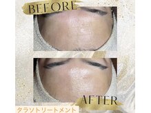 ララ(LARA)の雰囲気（たるみ改善＆リフトアップ！シミケアで透明感ある若々しい肌へ♪）
