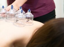 ウィル(will)の雰囲気（究極のデトックス！最強健康美容カッピング）