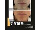 ダンニヒル(dannihil)の写真