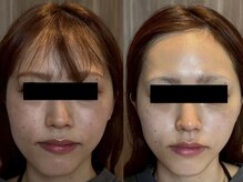 アンティアージュ 福岡本店(antiage)/左右対称の美しいお顔に