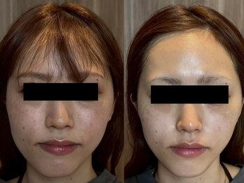 アンティアージュ 福岡本店(antiage)/左右対称の美しいお顔に