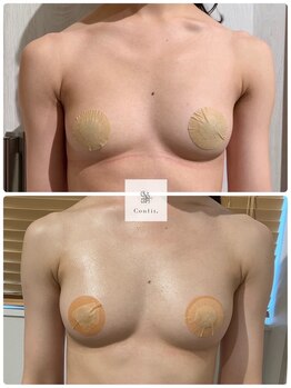 エルミナ.(elmina.)/左右差改善！ボリュームを実感♪