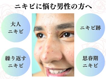 ニコリ 大宮(NICORI)の写真/男性にもおすすめ！ニキビ・凸凹跡・肌荒れ・繰り返しトラブルに＊水光プラズマ×炭酸シャワーで殺菌6倍！