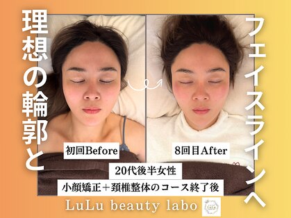 ルルラボ(LuLu beauty labo)の写真