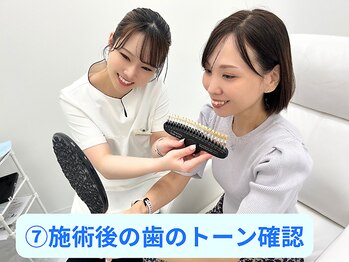 ホワイトニングカフェ アスピア明石店(WhiteningCafe)/☆施術後にも歯のトーンチェック