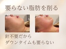 ワイズ 沖縄うるま院(Medical Y's)の雰囲気（サーマクールと脂肪燃焼でアゴ下もたつき解消。圧倒的な効果）