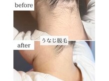 ノナ(nona)の雰囲気（愛されモテ美肌GET！どんなご相談にも寄り添います♪）