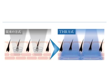 マーレ(Mare)/THR方式 VIO REX