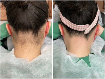 サロン ラズリ 久留米店(SALON Lazuli)/【うなじ脱毛】ワックス/光併用