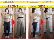 栄光治院 安城院/痩身ビフォーアフターブログ掲載