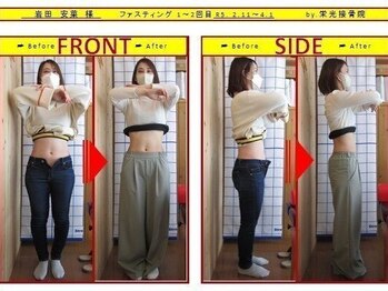 栄光治院 安城院/痩身ビフォーアフターブログ掲載