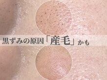 ラティエル(Latiele)/毛穴悩みは当店へ！