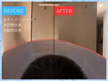 ティアワン 麻布十番(Tierone)/肩Before & After