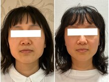 ウェリナ平和堂長久手院/小顔矯正/骨盤矯正/美脚サロン