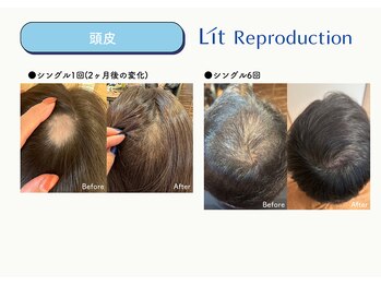 アニュー(anew.)/【Lit症例】フェイシャル