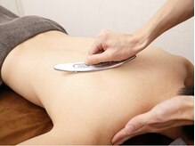 西町通り整骨院/筋膜リリース