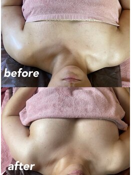 リラクゼーションエステ アジュール(Azur)/【施術4回】