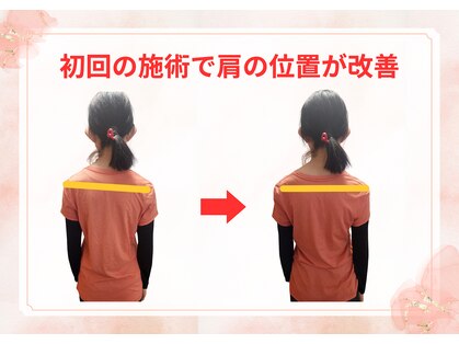 3Rボディメンテナンスの写真