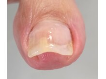 001 新横浜/両側も一回で矯正できます