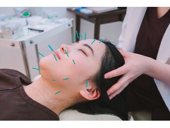 メタ鍼灸院の写真/"切らずに左右対称の美小顔"メタ式小顔鍼灸60分 ¥8800～エステ超えの効果を体感したいあなたにオススメ◎