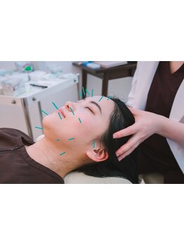 小顔になりたい