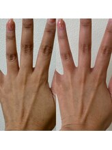 フェリーチェネイル(felice Nail)/血行促進パラフィンパック