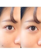 エンズ 代官山(O`s)/フラットラッシュ100本