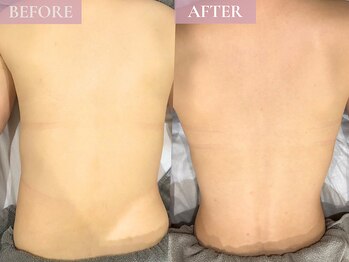 ベベ 表参道(bebe)/ブライダル