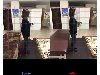 ストレチックス 近江八幡店/肩甲骨周りのコリ、腰の痛み撃退
