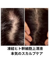 ヘリオス(helios+)/CPJ幹細胞上清液を贅沢に導入