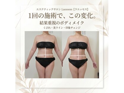 ラエッセス(A Laessess)の写真