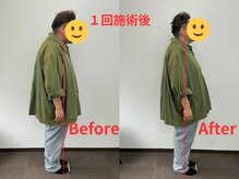 シームル