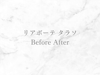 リライン(ReLine)/【リアボーテ タラソ】