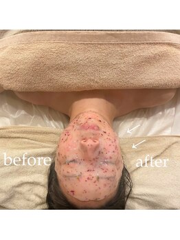 ミルズ(MillS)/リフトUPフェイシャル