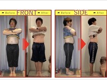 栄光治院 安城院/痩身ビフォーアフターブログ掲載