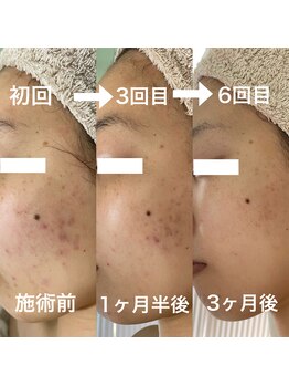 シェノン 赤坂大濠店/