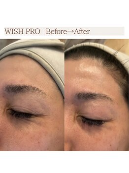 ブルーム(BLOOM)/WISHproビフォーアフター