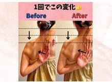 トータルボディケアスマイル(Smile)の雰囲気（筋膜リリースは、腕が上がりにくい方にもオススメ！）