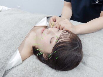 ハリカ 恵比寿 代官山店(HARIKA)/顔/顎神経麻痺に効果的な美容鍼